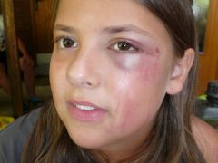 122   WiW   SOLA2015